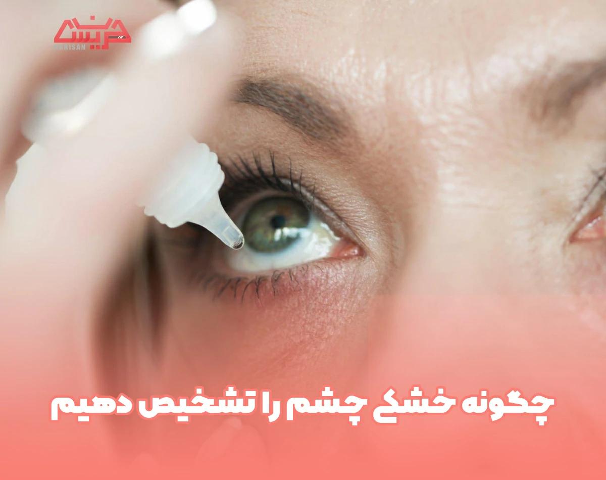چگونه خشکی چشم را تشخیص دهیم